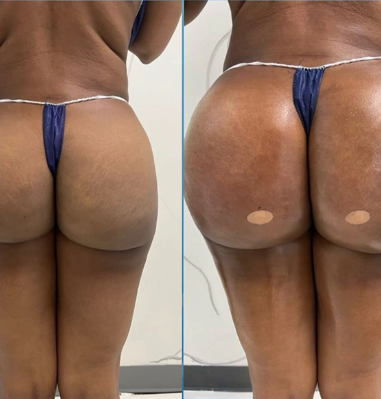 Technician preparing pipe relining