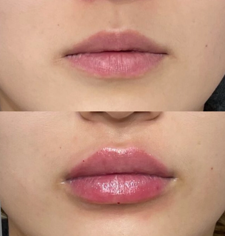 Technician preparing pipe relining