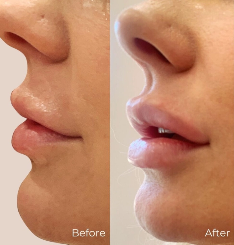 Technician preparing pipe relining