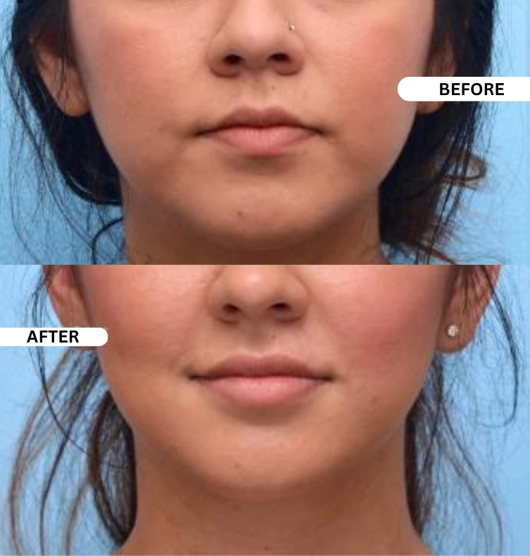 Technician preparing pipe relining